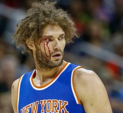 Robin Lopez