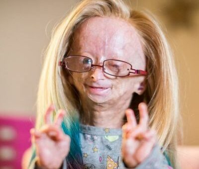 Adalia Rose